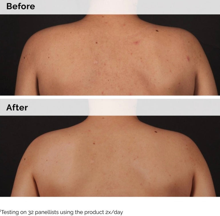 The Ordinary- Body Care