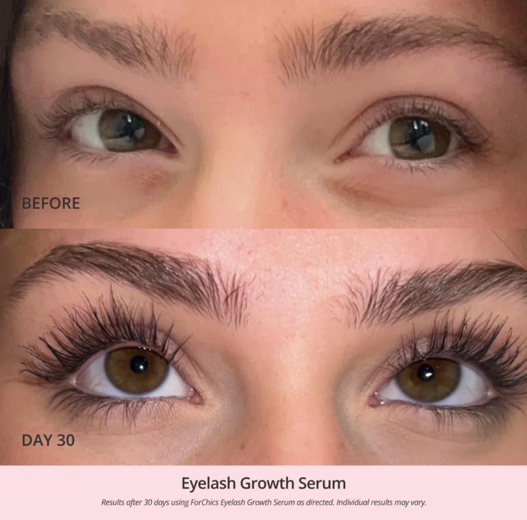 FORCHICS - Eyelash Growth Serum