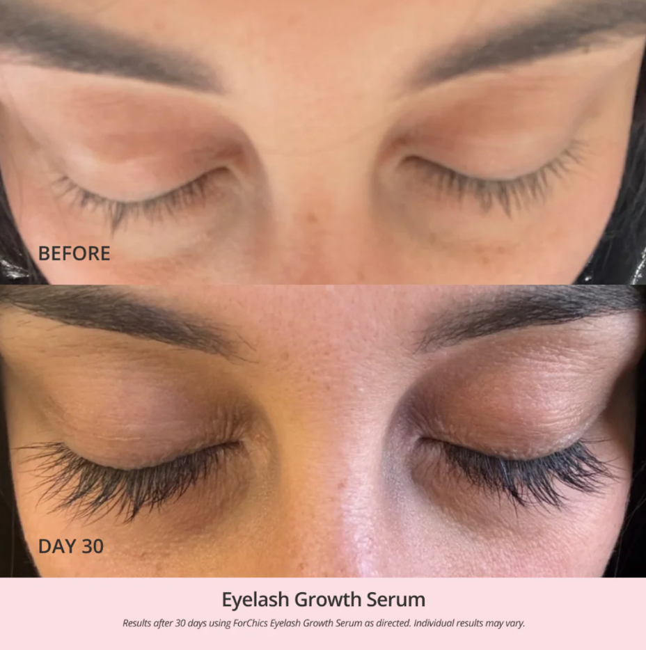 FORCHICS - Eyelash Growth Serum