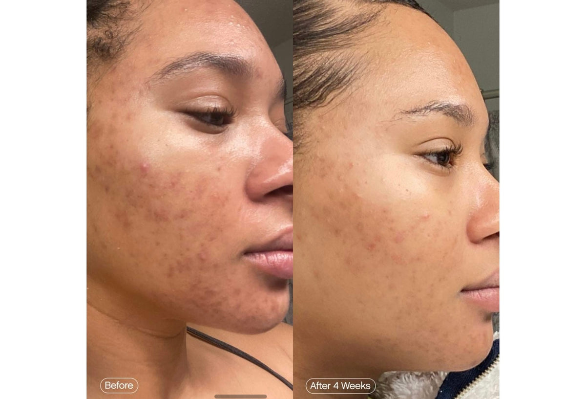 TOPICALS Faded Serum for Dark Spots & Discoloration
